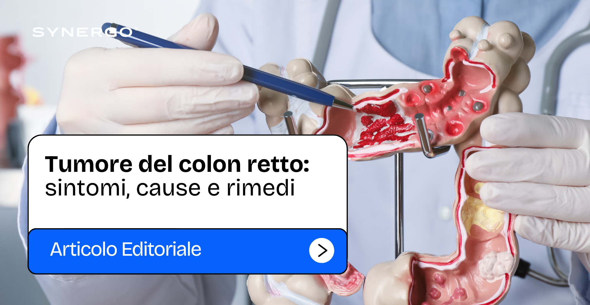 Tumore Del Colon Retto Che Cos Quali Sono I Numeri Come Si Cura Tumore Del Colon Retto Che Cos Quali Sono I Numeri Come Si Cura